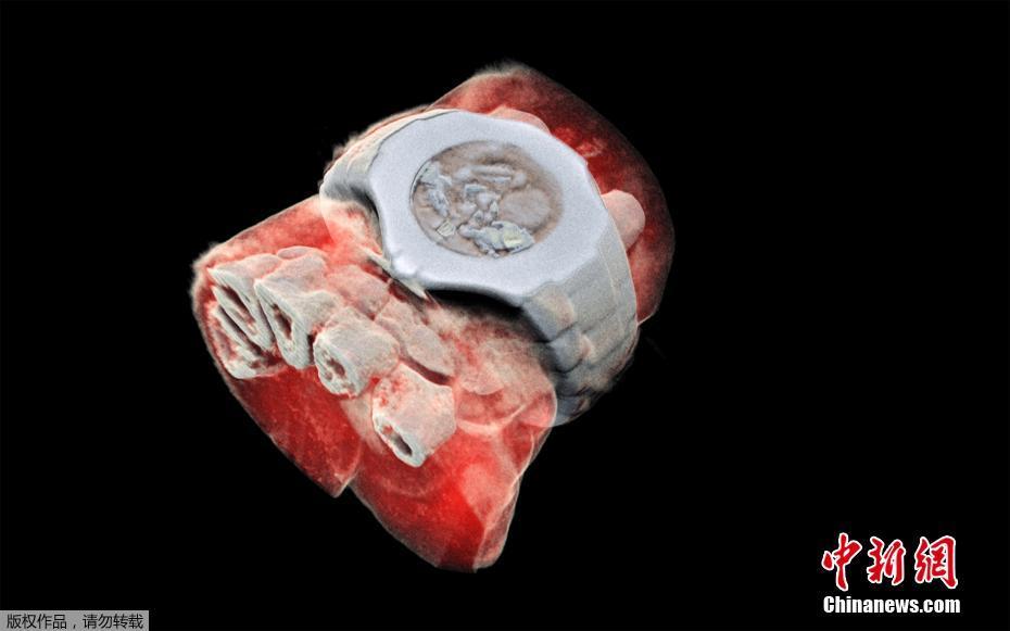世界第一张人体3D彩色X光片曝光