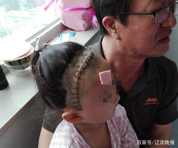 沈阳警方破获5岁女童被铅弹击中案 嫌犯系同小区居民