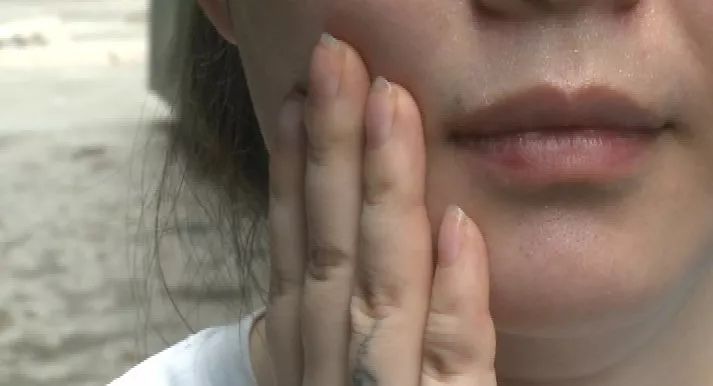 2000元瘦脸针打后 深圳女子半边脸突然剧烈疼痛
