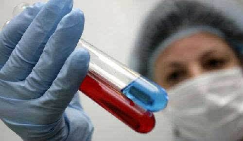 世卫组织癌症报告：亚洲是重灾区，这三种癌罹患人数最多