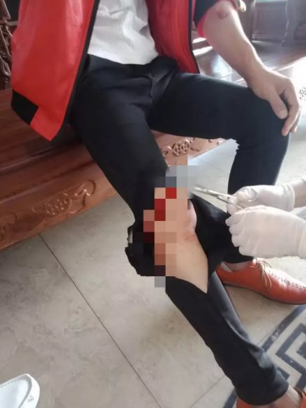 男子与女网友酒店开房 拒给对方 200 元避孕费后悲剧