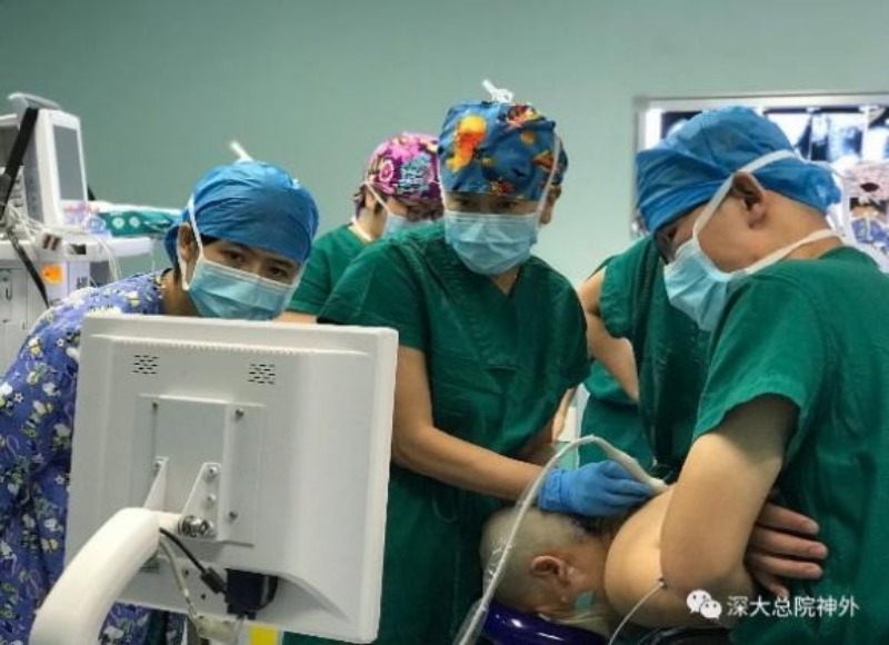 精准切除癫痫病灶​ 深圳医生给了她重生的起点