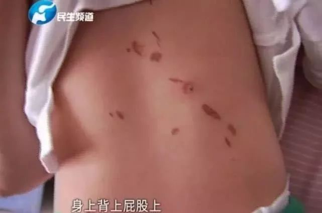 妈妈给小孩洗澡，头顶突然“砰”一声发生了爆炸.......