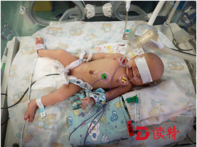 产妇半夜难产 龙华人民医院与慈善基金会合力救助