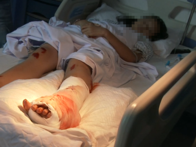 11岁女孩遭泥头车碾压骨折！乖女孩无生命危险在病床上预习功课