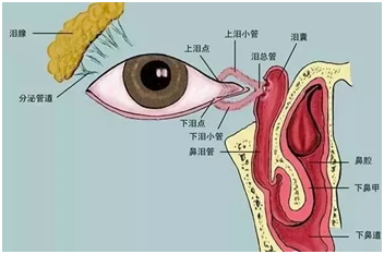 莫名流泪，不是因为多愁善感，都是泪囊炎惹的祸！
