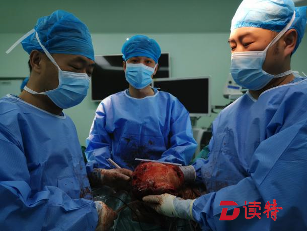 老伯咳嗽七年睡觉总憋醒，原来胸腔里竟长了四斤重肿瘤！
