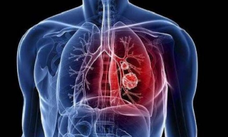 河南省新增输入性新型肺炎确诊病例4例：均有武汉居住史