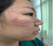 在集装箱改装的发热门诊里，松岗这群医护人员在日夜“战疫”