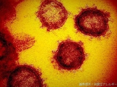 日本国内确诊新冠肺炎1403例，死亡47人
