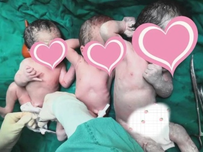 跨城来深生二胎，惠州女子喜迎三胞胎