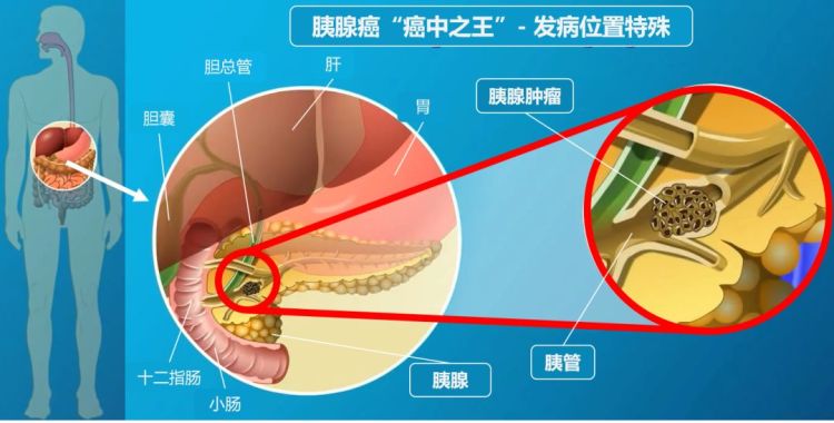 项目来了 | 深圳团队给国产超声系统找“眼睛”
