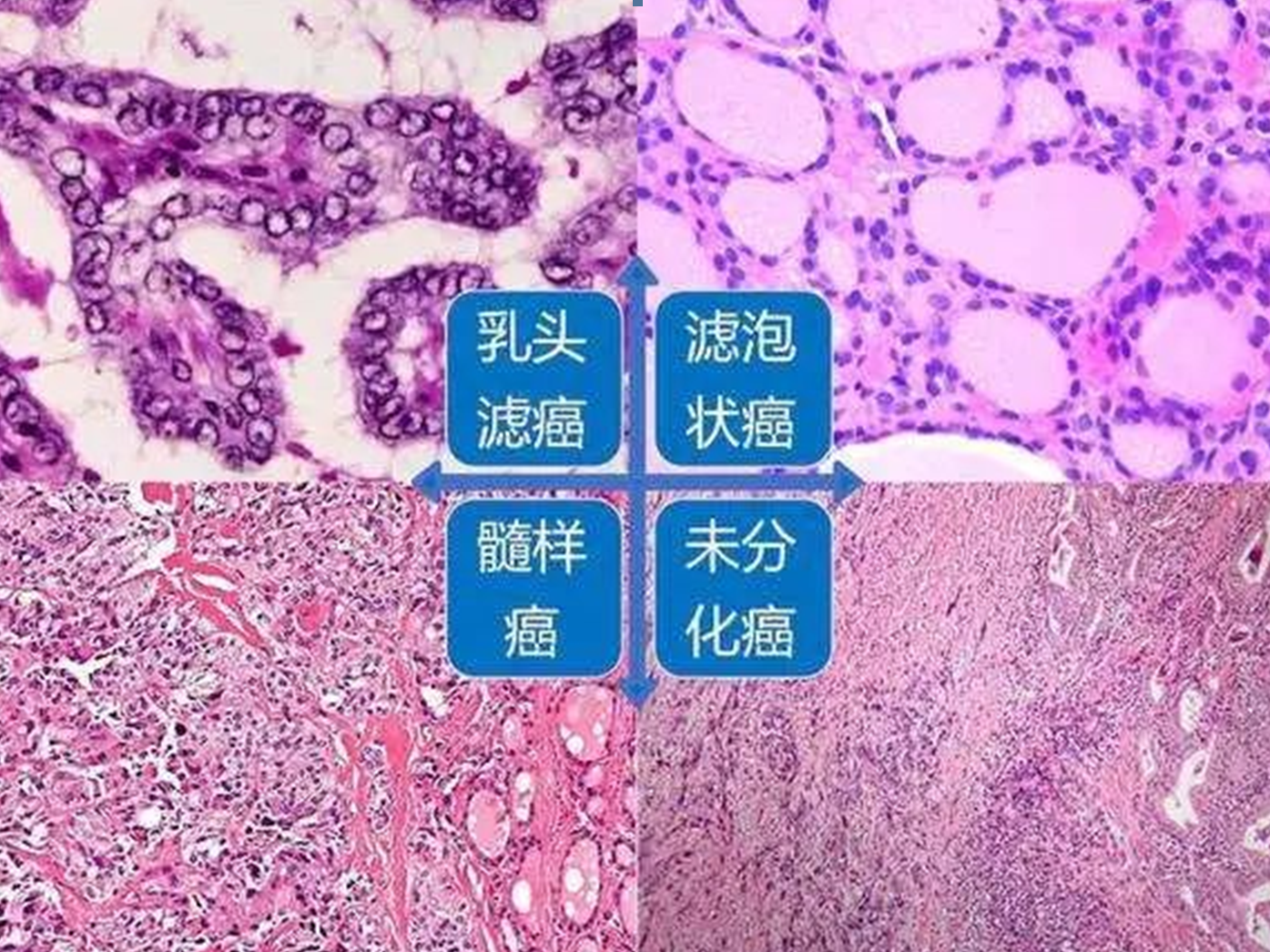 面对这种“懒癌”，不能掉以轻心！最有效的应对是这样