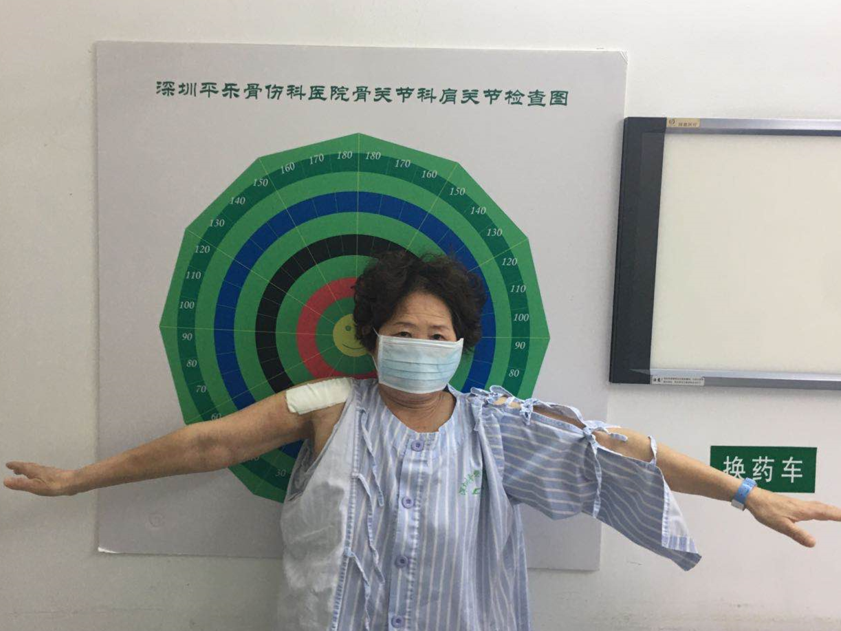 意外摔伤老人肩膀几“报废”！平乐医院反式肩关节置换成功“拯救”