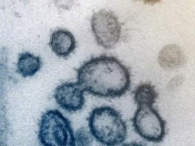 哈佛大学研究称新冠病毒去年8月已传播，世卫：无证据支持