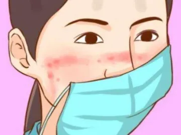 健康365 | 手疹、爆痘……疫情之下如何拯救皮肤？
