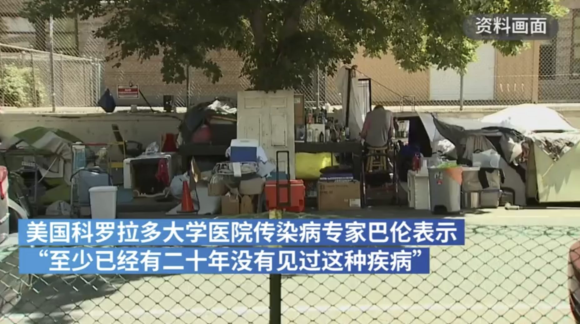 美国4名流浪汉感染战壕热，专家称20年未见