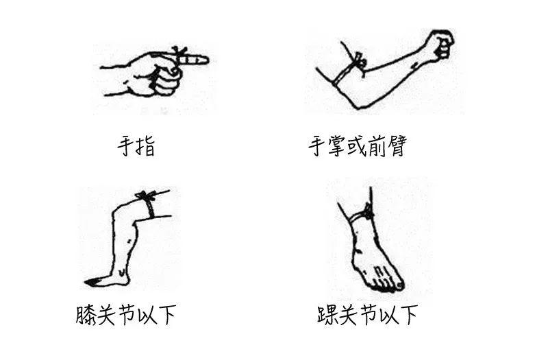 深圳多处绿化地“蛇出没”！步行遇到蛇该怎么办？