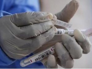 韩国发现3例新冠和流感双重感染病例，美国等国也曾出现