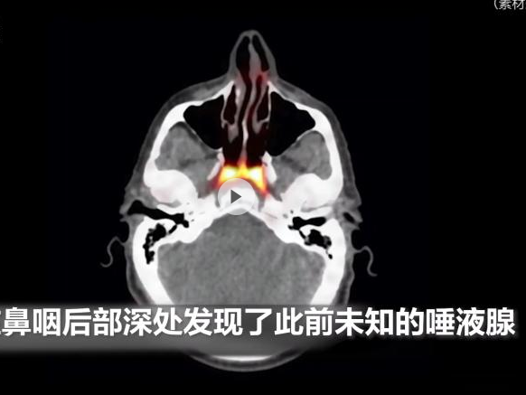 研究发现此前未知的人体器官 新发现腺体有助防止放疗副作用