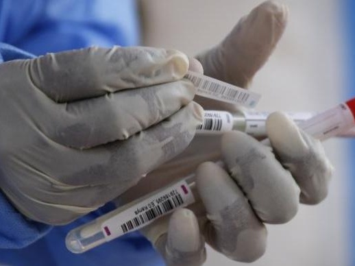 非洲确诊超200万例，卫生官员称对疫苗“期待”又“担忧”