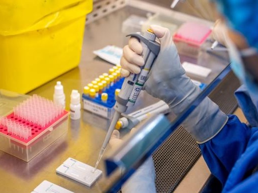 港大传染病专家：不排除变种新冠病毒影响疫苗成效和检测方法