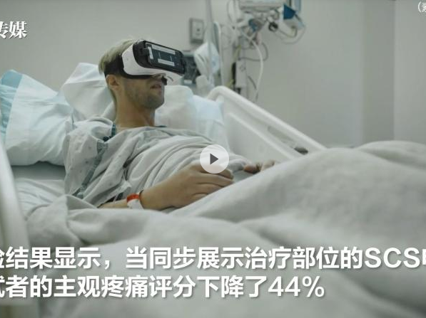 “虚拟现实”可以止痛？ 实验证明VR让患者痛感降低44%