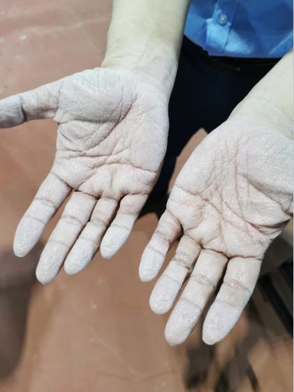 一双被汗水泡得苍白起皱的手；一位抗疫前线的年轻父亲