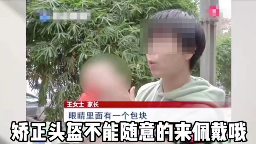 2.8万的“头盔”让婴儿头型变美？医生：影响发育